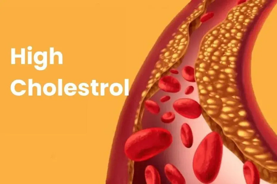 What Are 10 Warning Signs of High Cholesterol?