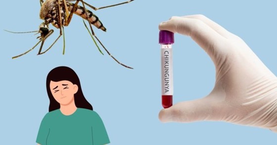 Chikungunya Spreads to Taiwan from China Outbreak
