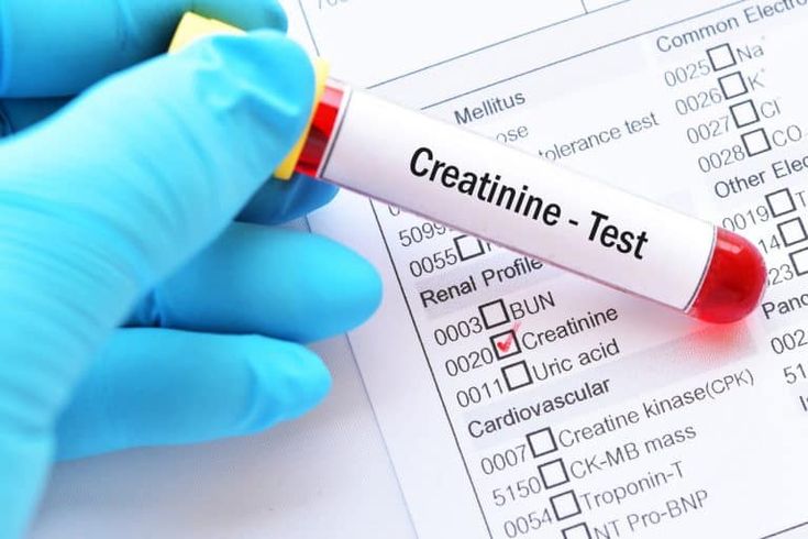 Is Your Kidney Function Declining? Creatinine Test Explained for Early Detection by Doctors post thumbnail image