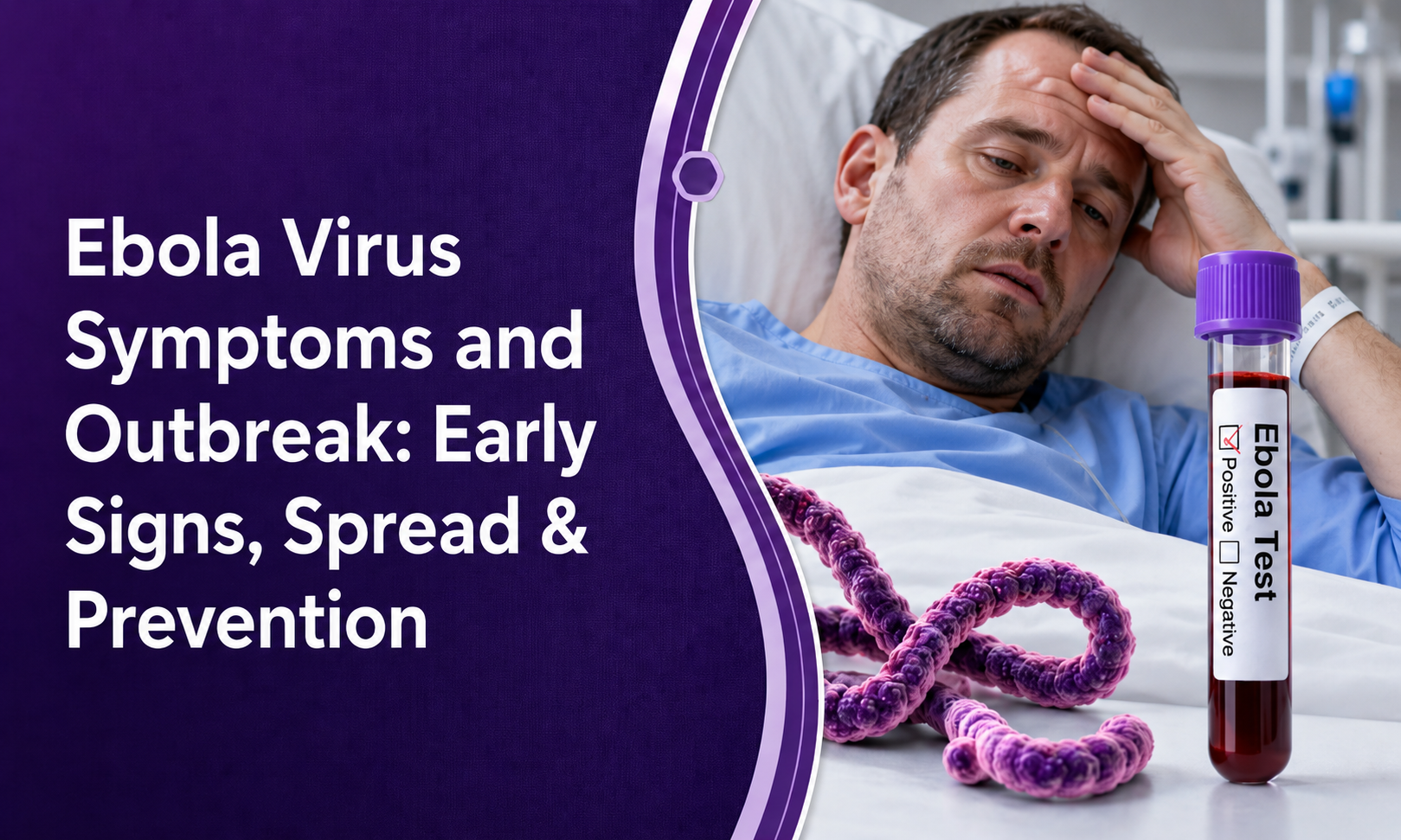 Ebola Virus Symptoms and Outbreak: Early Signs You Should Never Ignore post thumbnail image