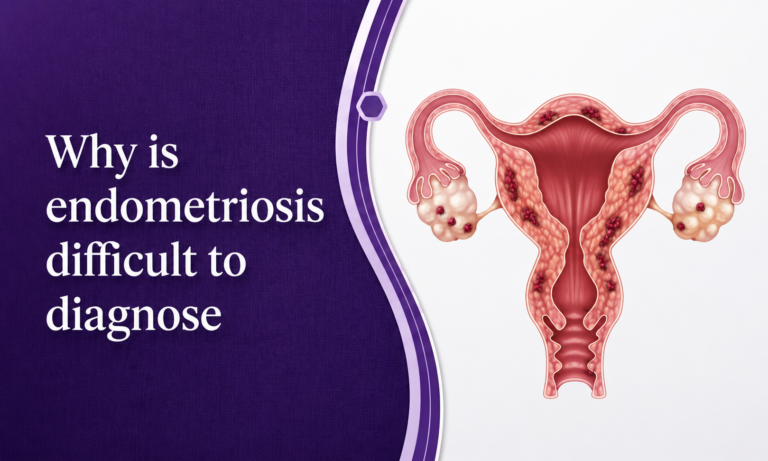 Why is endometriosis difficult to diagnose