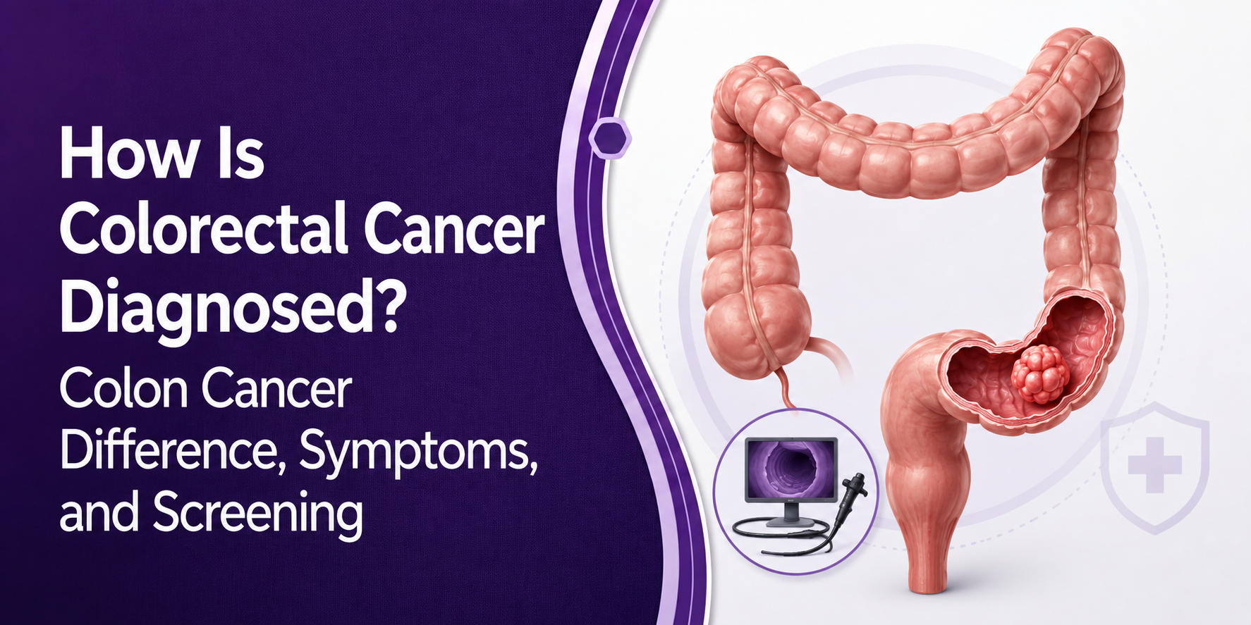 How Is Colorectal Cancer Diagnosed? Colon Cancer Difference, Symptoms, and Screening post thumbnail image