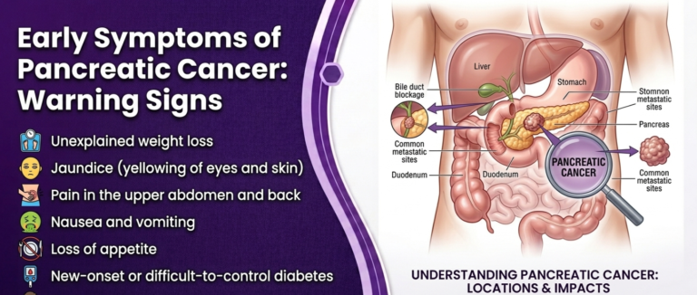 Early Symptoms of Pancreatic Cancer