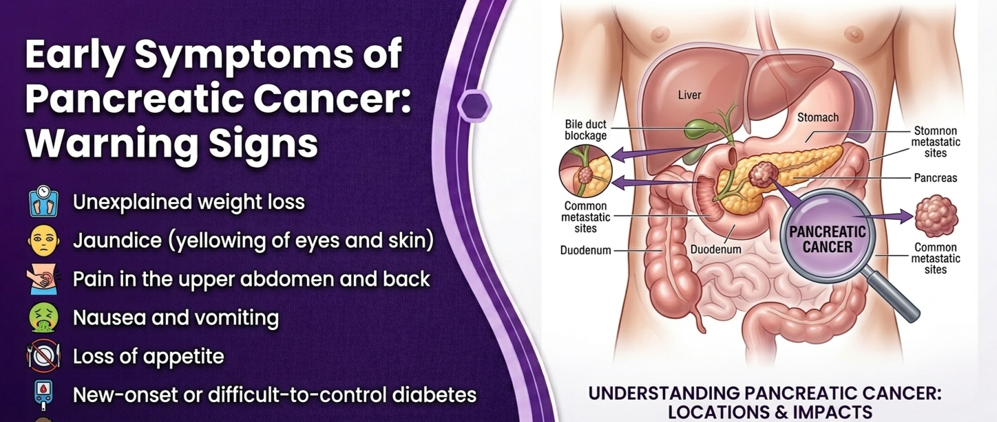 Early Symptoms of Pancreatic Cancer