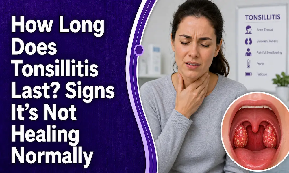 How Long Does Tonsillitis Last