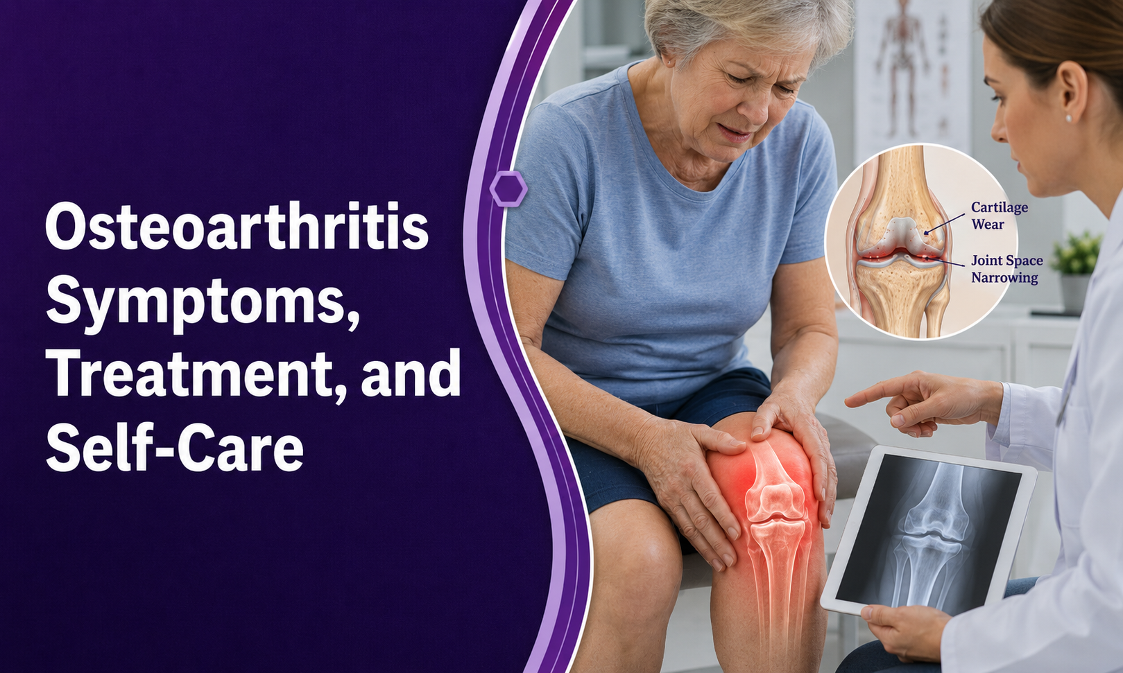 Osteoarthritis Symptoms, Treatment, and Self-Care: Can It Affect Life Expectancy?