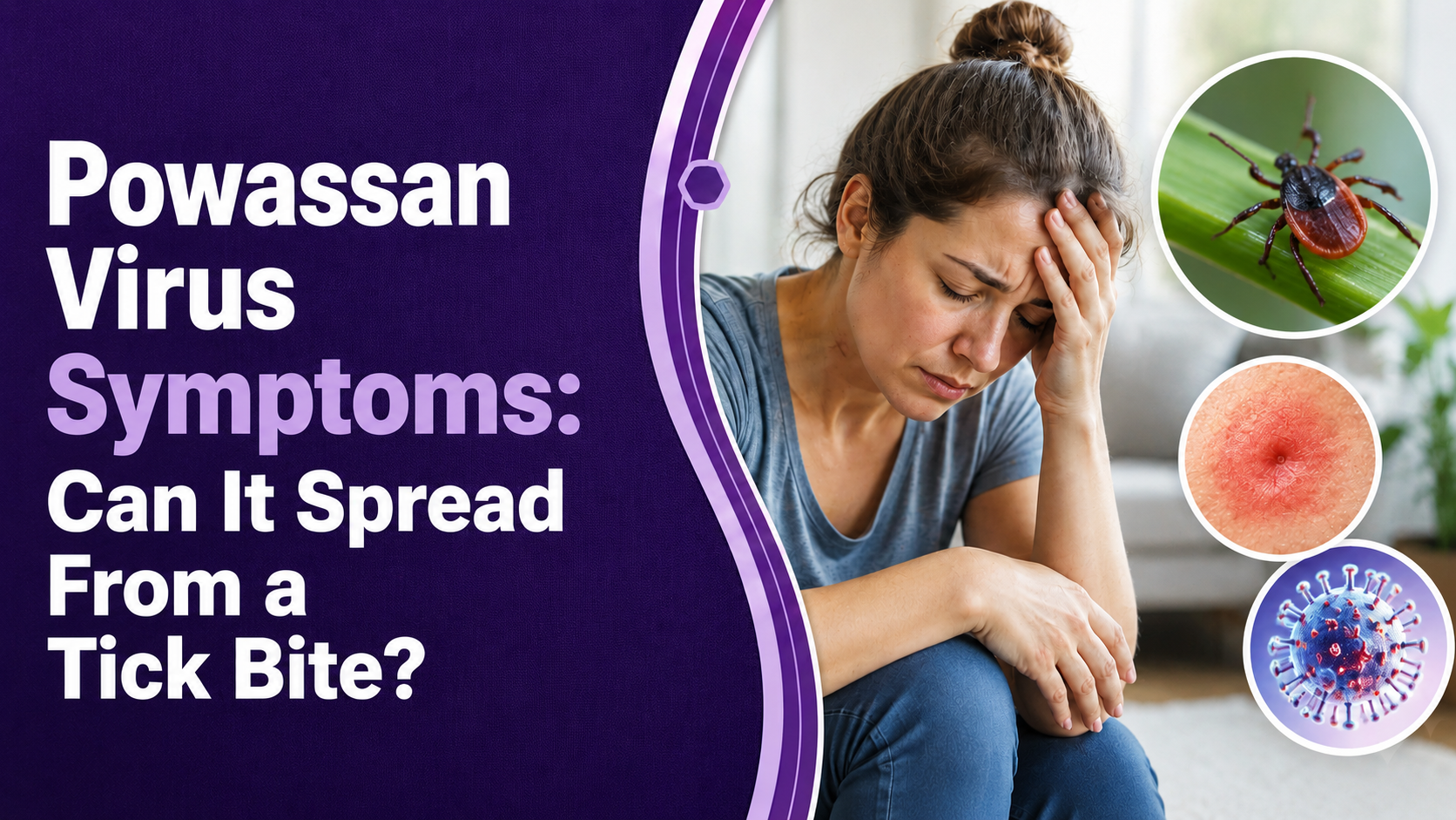 Powassan Virus Symptoms: Can It Spread From a Tick Bite?