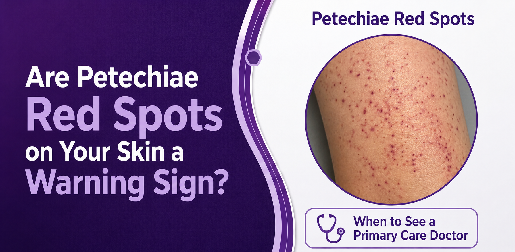 Are Petechiae Red Spots on Your Skin a Warning Sign?