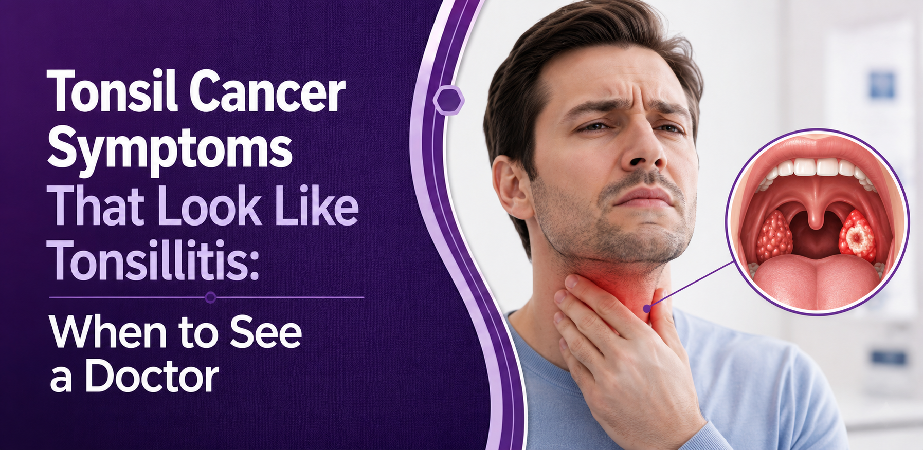 Tonsil Cancer Symptoms That Look Like Tonsillitis: When to See a Doctor
