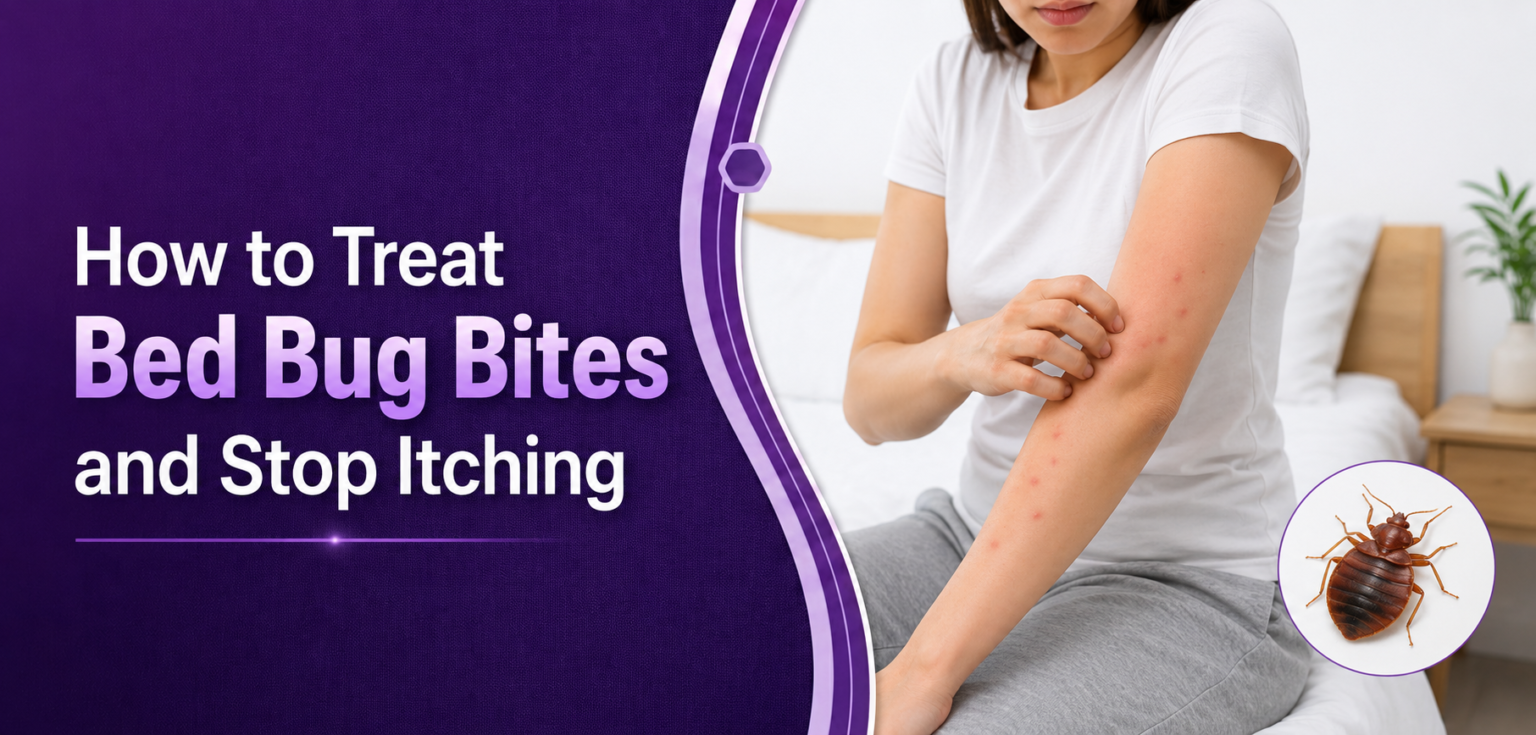 how-to-treat-bed-bug-bites-and-stop-itching-signs-and-rash-alert