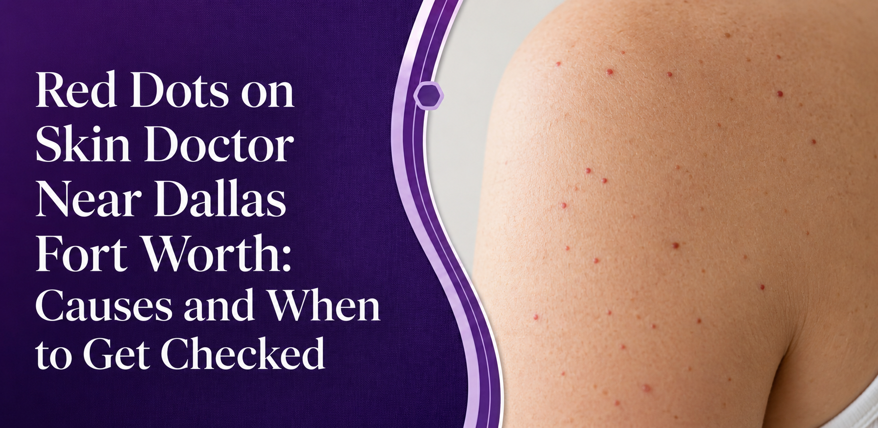 Red Dots on Skin Doctor Near Dallas Fort Worth: Causes and When to Get Checked post thumbnail image