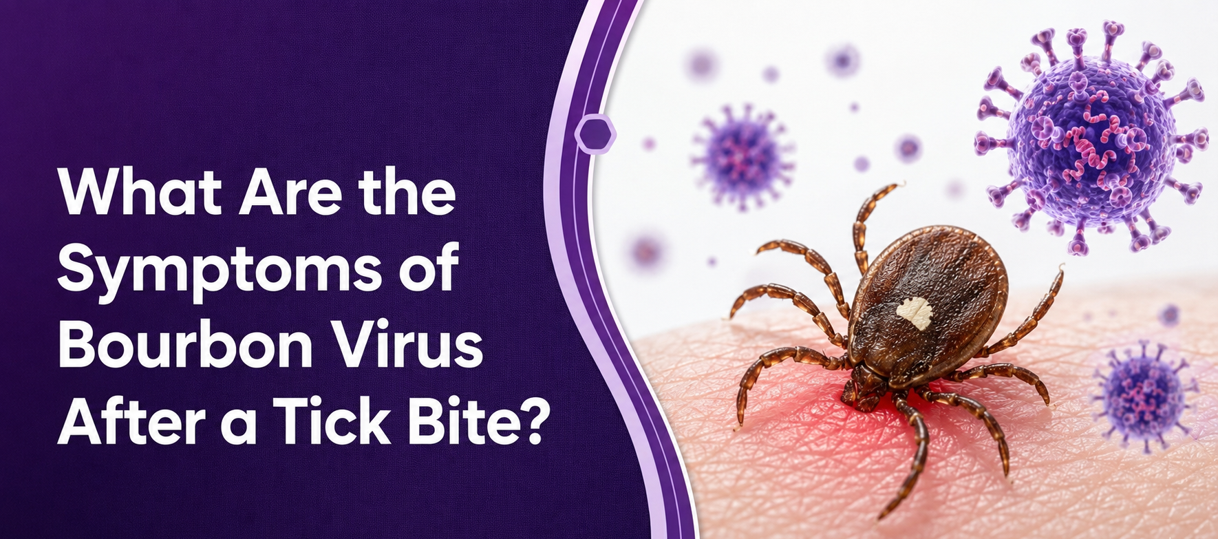 What Are the Symptoms of Bourbon Virus After a Tick Bite?