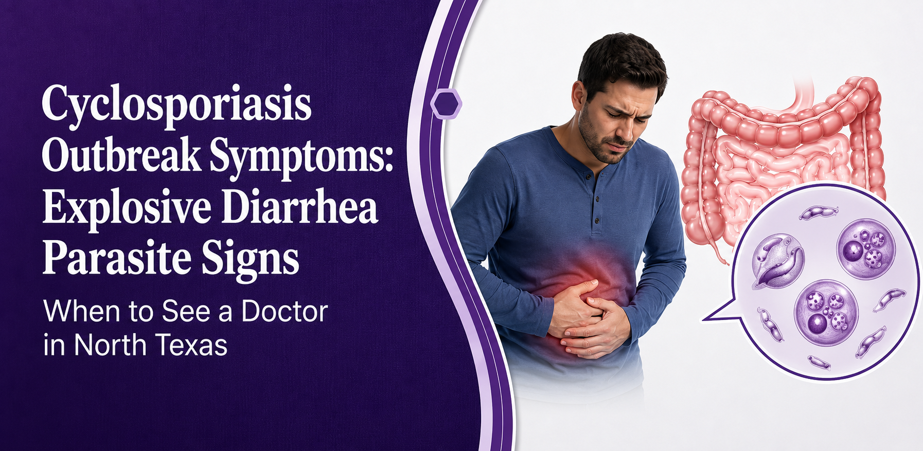Cyclosporiasis Symptoms Outbreak: Explosive Diarrhea Parasite Signs and Get Primary Care in North Texas