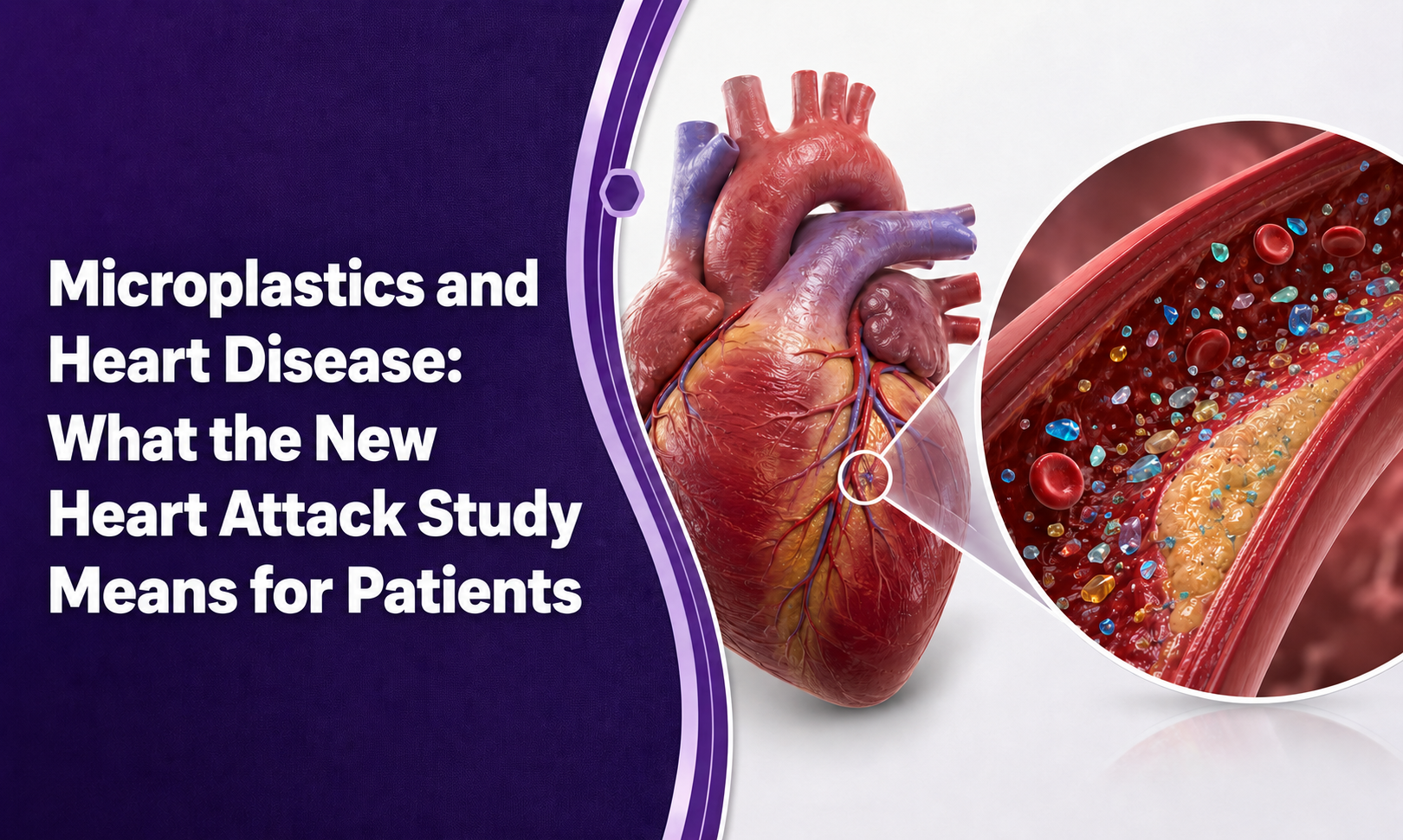 Microplastics and Heart Disease: What the New Heart Attack Study Means for Patients