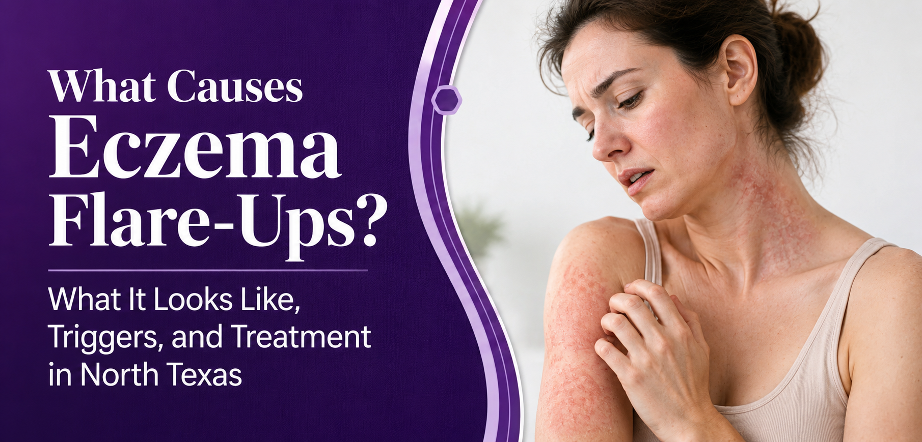What Causes Eczema Flare-Ups? What It Looks Like, Triggers, and Treatment in North Texas