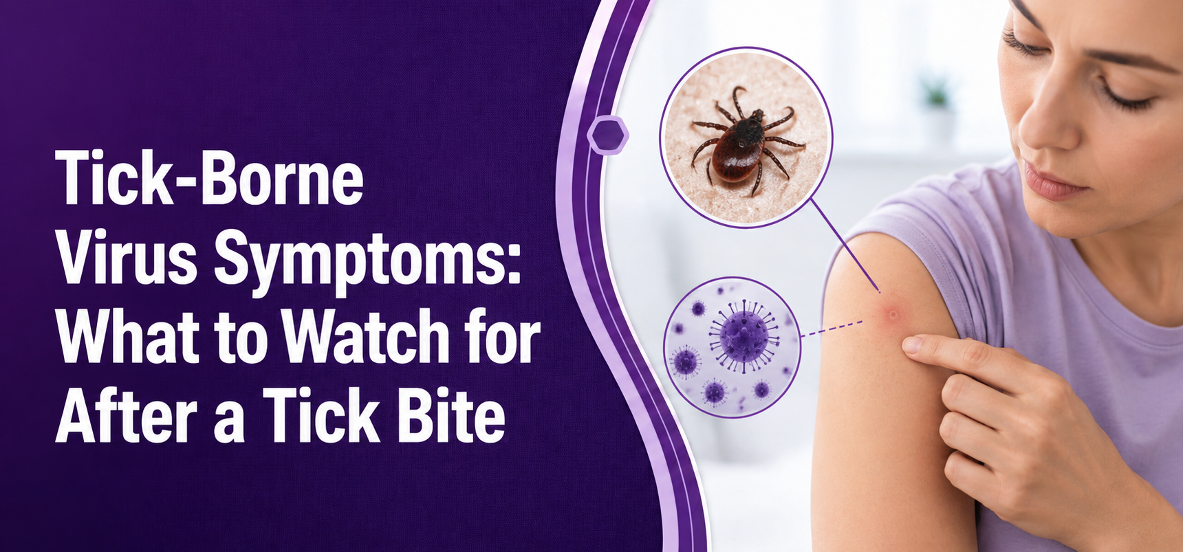 Tick-Borne Virus Symptoms: What to Watch for After a Tick Bite
