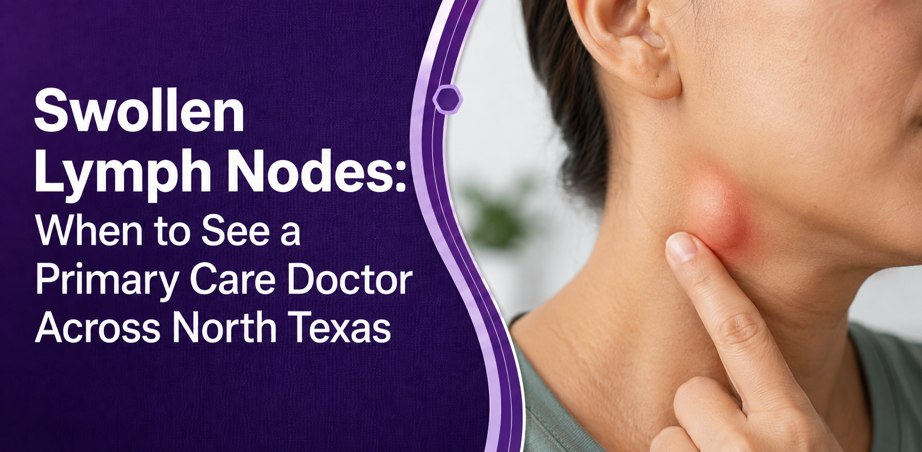 Swollen Lymph Nodes: When to See a Primary Care Doctor Across North Texas