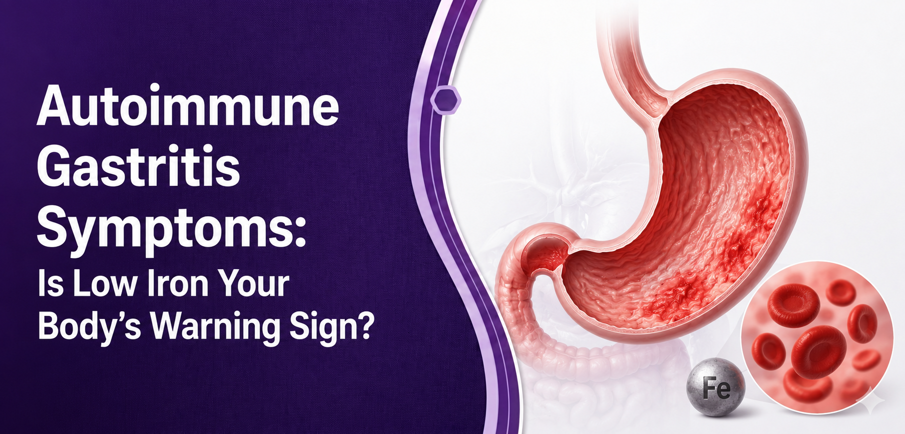 Autoimmune Gastritis Symptoms: Is Low Iron Your Body’s Warning Sign?