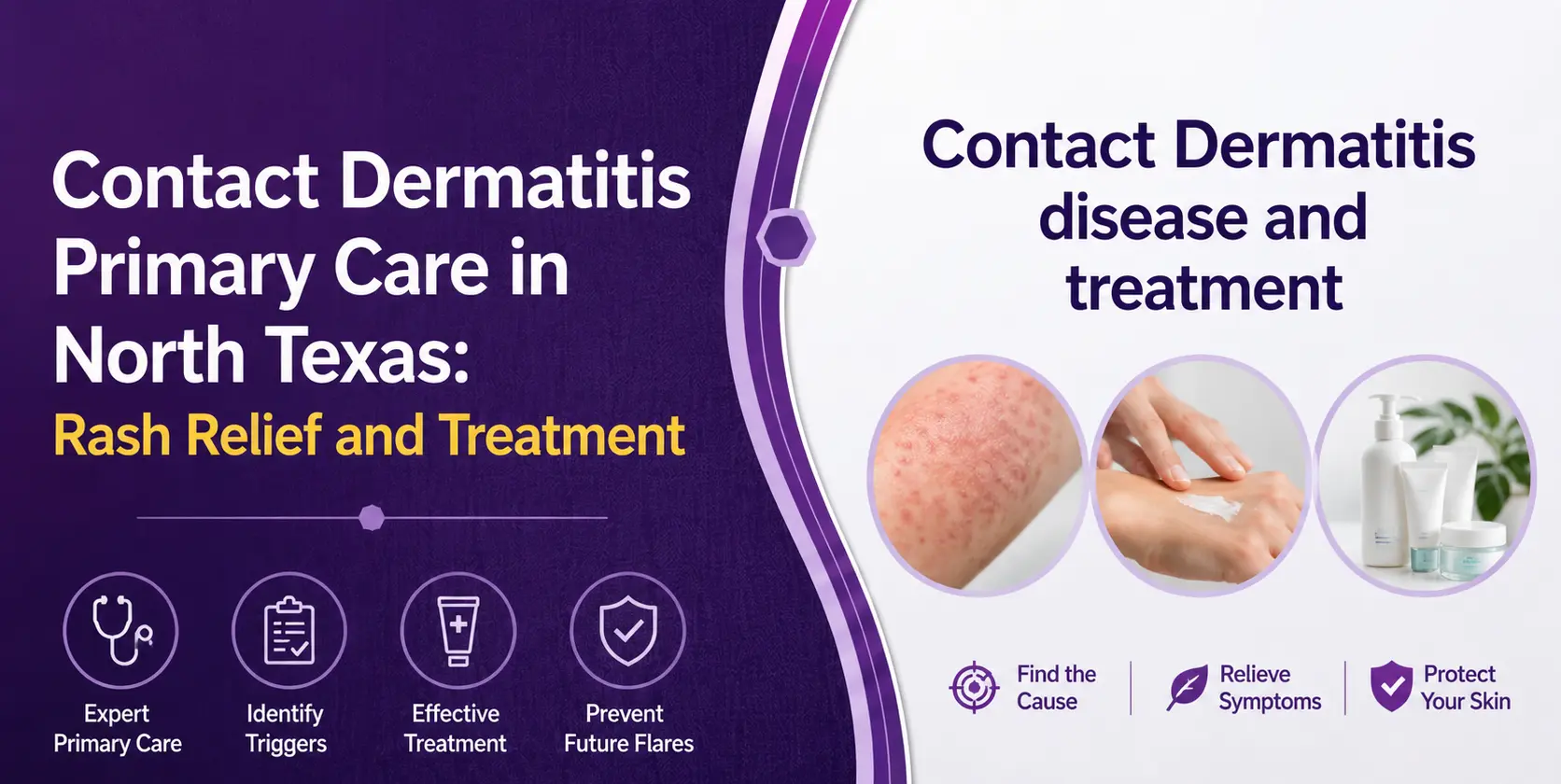 Contact dermatitis primary care