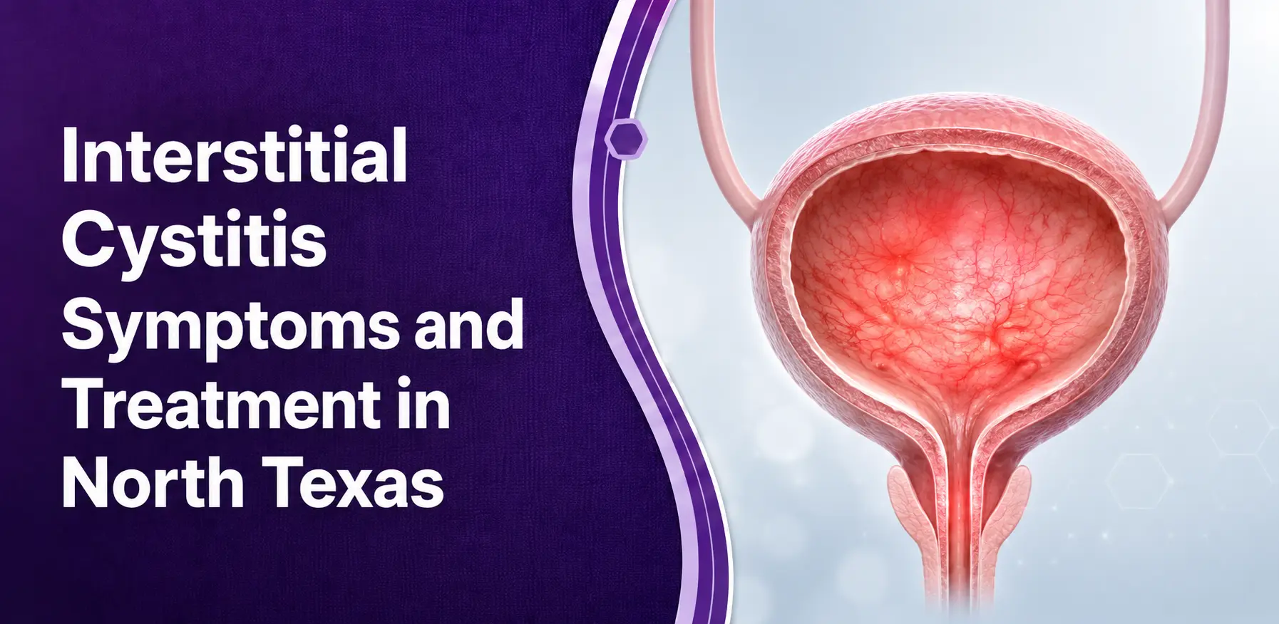 Interstitial cystitis symptoms and treatment
