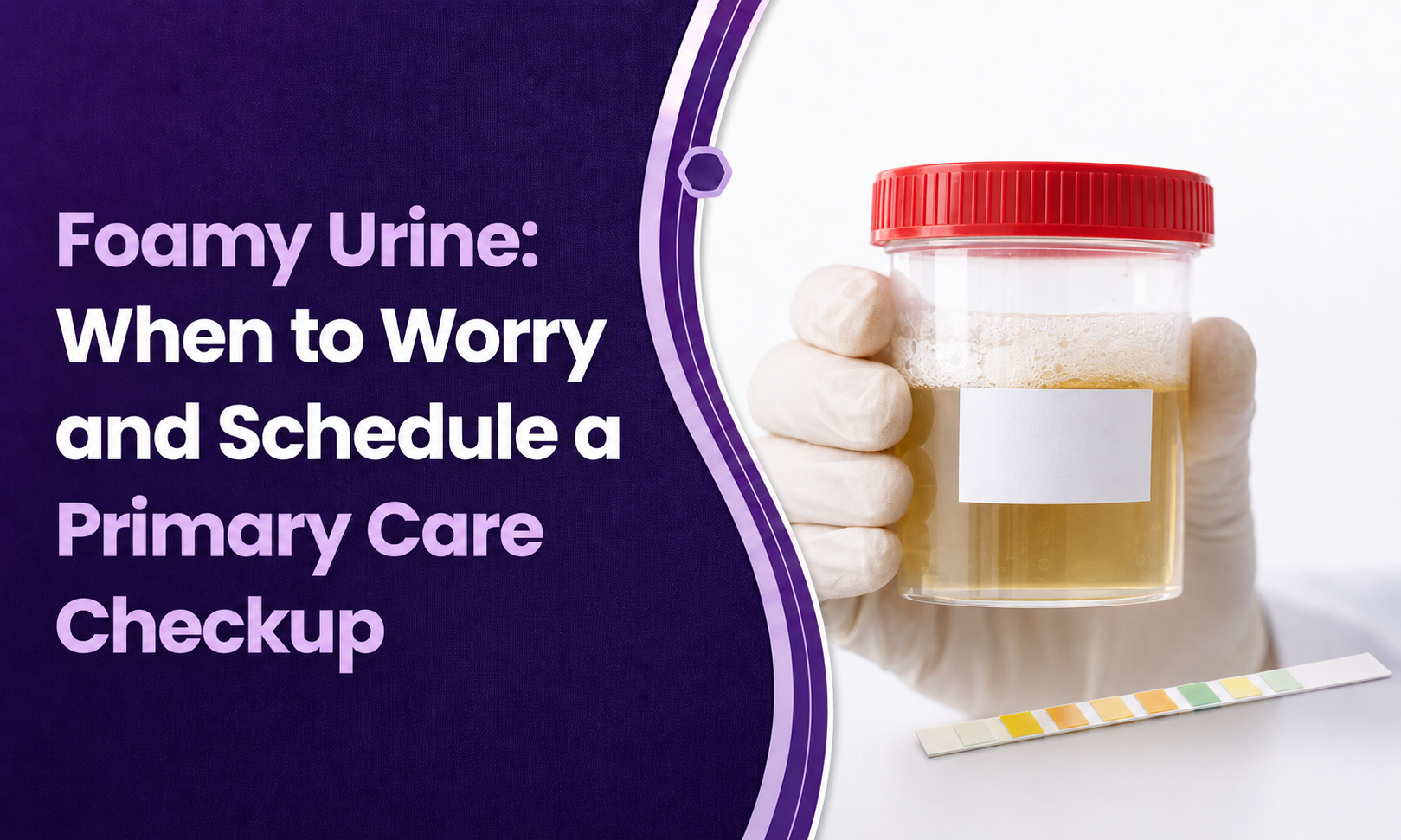 Foamy Urine: When to Worry and Schedule a Primary Care Checkup post thumbnail image