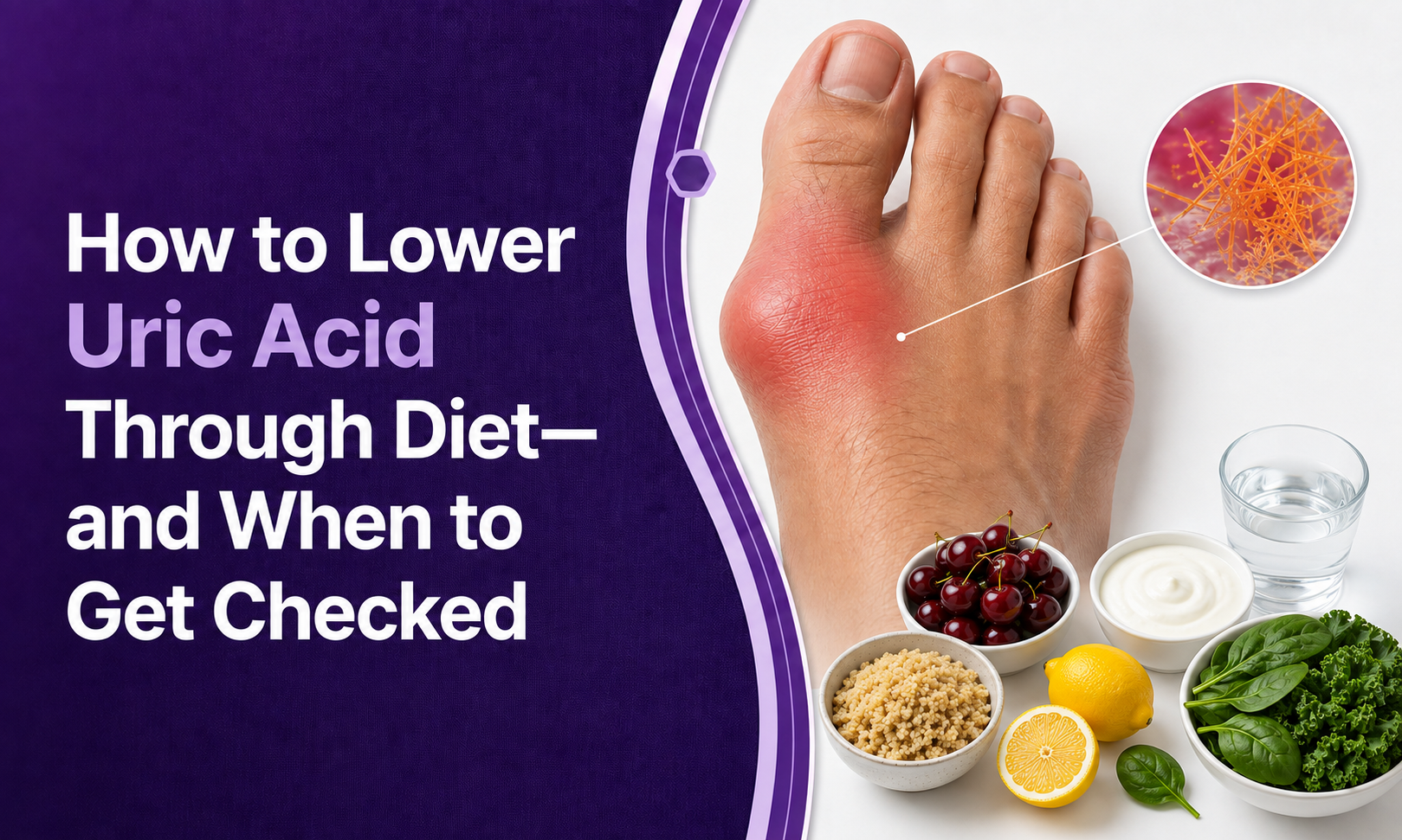 How to Lower Uric Acid Through Diet—and When to Get Checked post thumbnail image