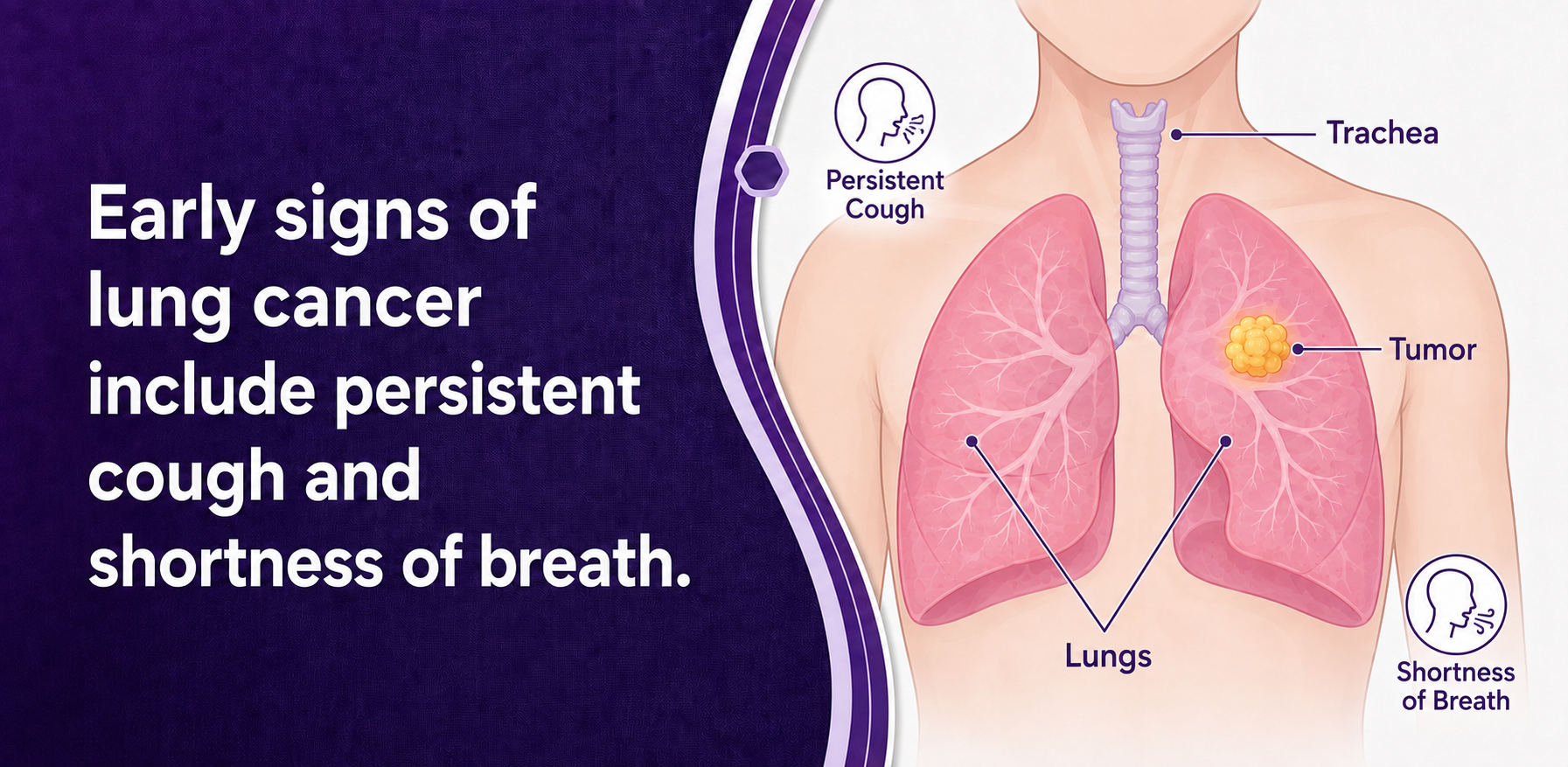 Lung Cancer Warning Signs: What Should You Never Ignore?