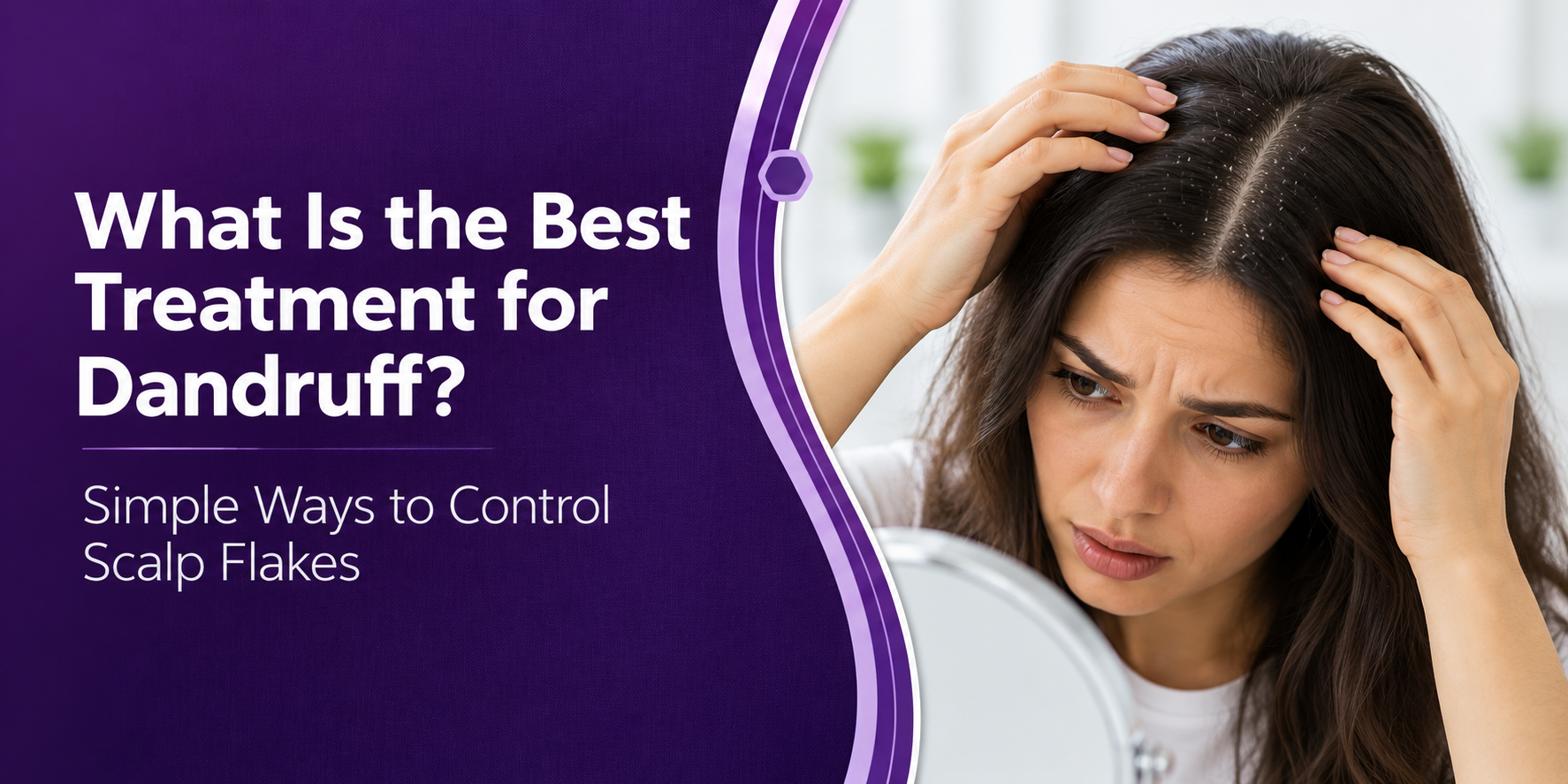 What Is the Best Treatment for Dandruff?