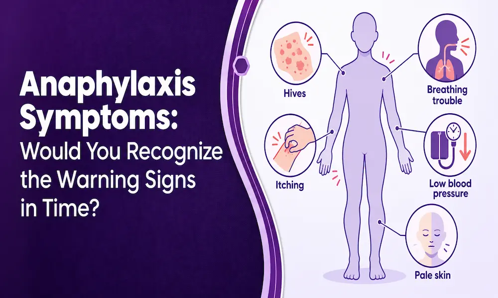 Anaphylaxis Symptoms: Would You Recognize the Warning Signs in Time?