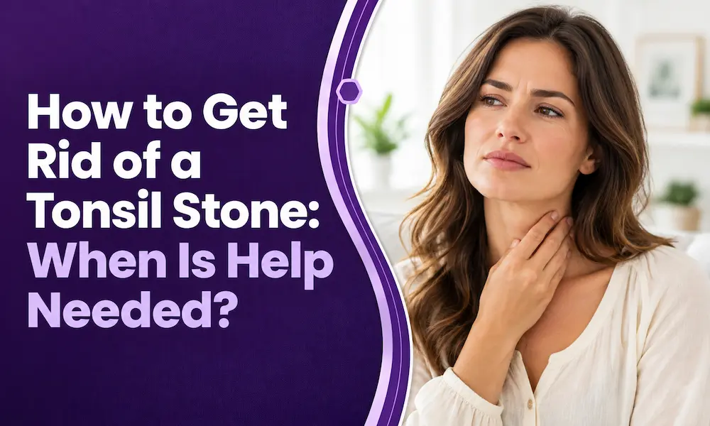 How to Get Rid of a Tonsil Stone: When Is Help Needed?